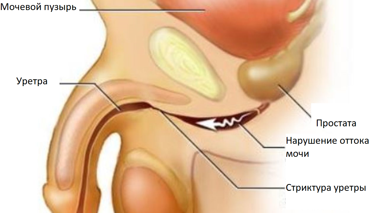 Уретра Мужская Где Находится Фото