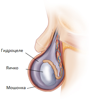            UroWebru    