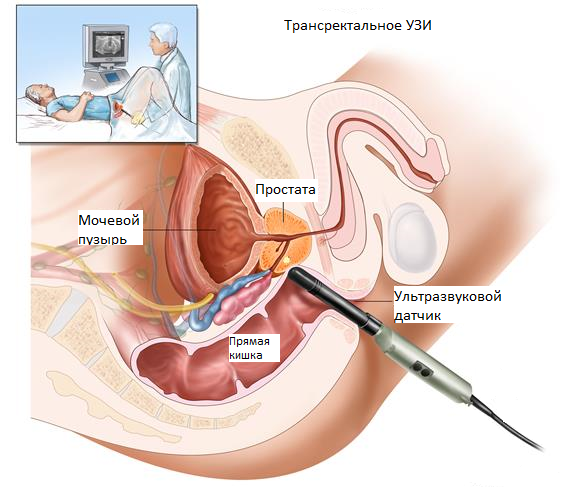 Контрольная работа по теме Методы оперативного лечения доброкачественной гиперплазии предстательной железы